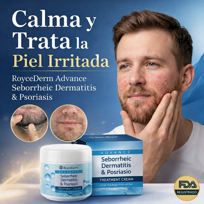 RoyceDerm Seborrheic Dermatitis